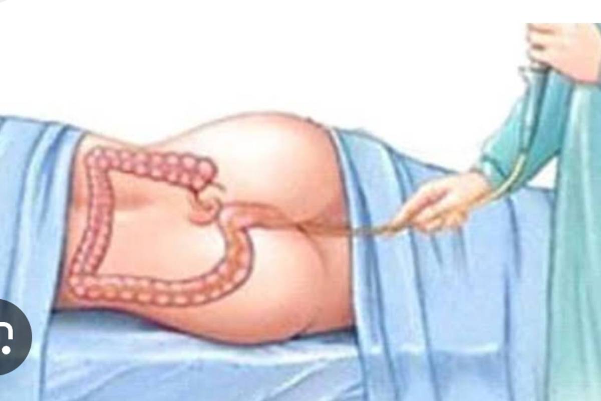 Vasthi therapy at home in Hyderabad